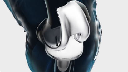 Technical Paper Critical Particles on Medical Products