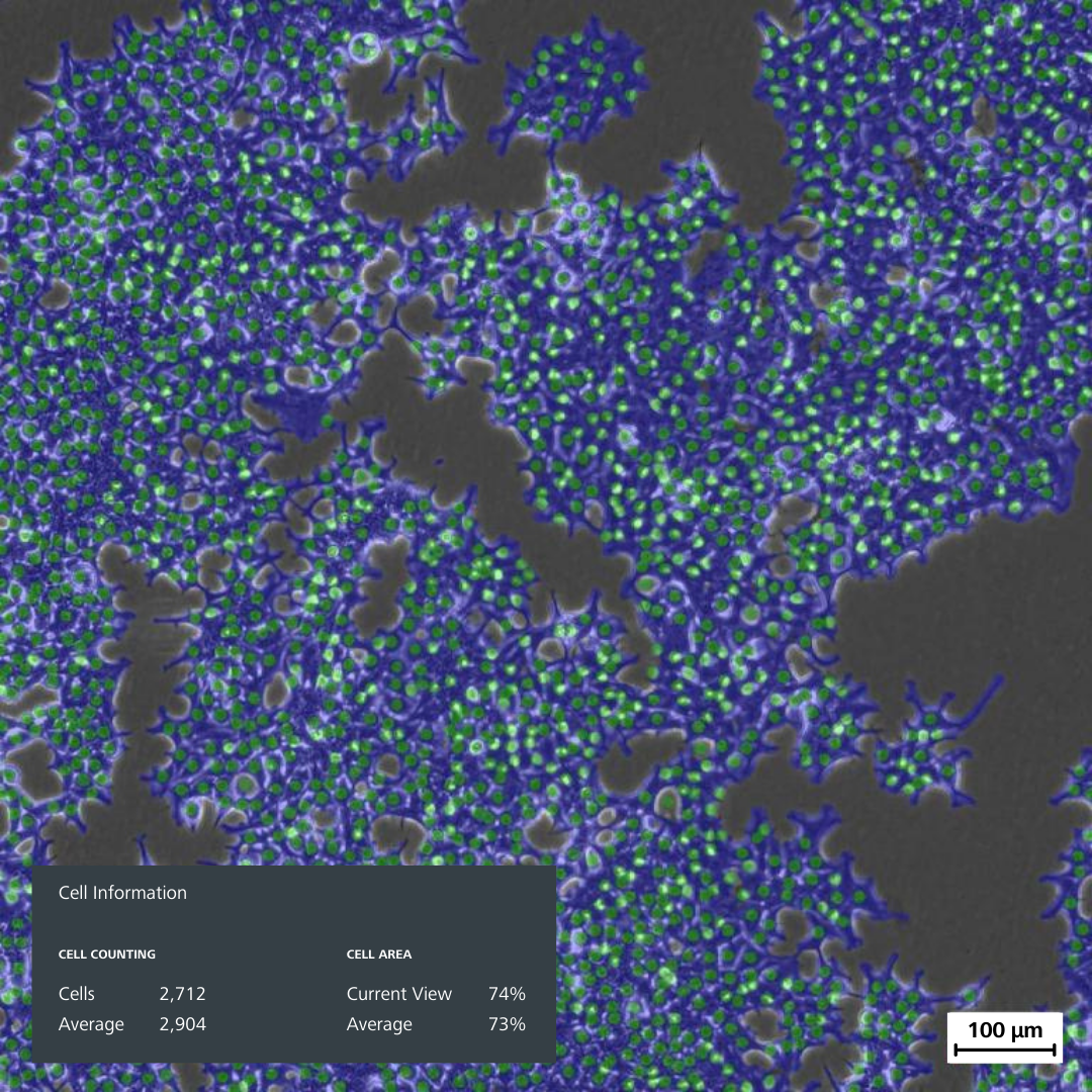 Labscope module for Cell counting and cell confluency. AI Cell count, AI Cell confluency