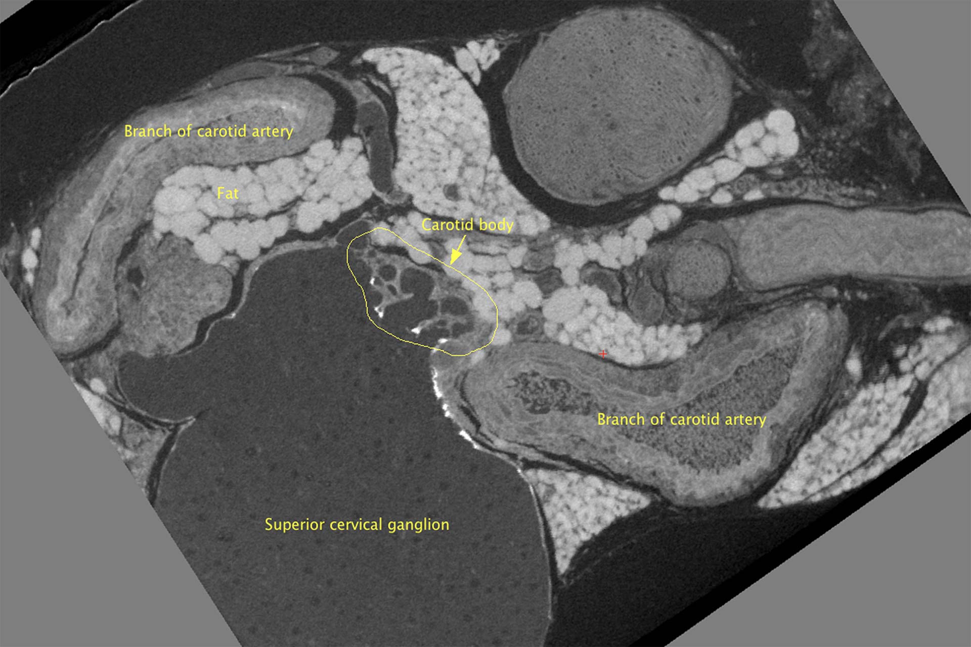 2D slice from a 3D reconstruction of a sample prepared for serial blockface scanning electron microscopy (SBF-SEM). The X-ray microscope image captured with the ZEIS Xradia Versa was used for subsequent sample trimming and targeted acquisition using volume EM. 