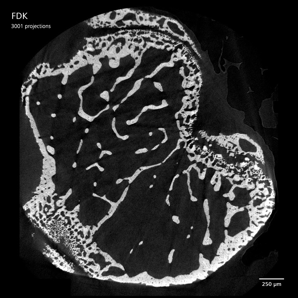 Mouse cortical bone imaged with ZEISS Xradia Versa, reconstructed using FDK with 3001 projections