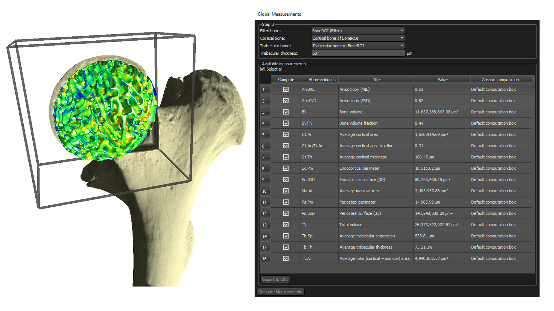 Mouse long bone segmented and analyzed to generate some of the standard quantifiable measures for bone Sample courtesy of Daniel Wescott, University of Texas at San Marcos.