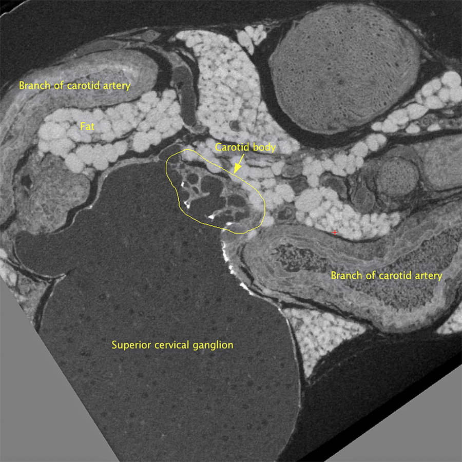 2D slice from a 3D XRM dataset, prepared for serial block-face SEM. Courtesy of Alana Burrell @EM_STP, CRICK Institute, United Kingdom