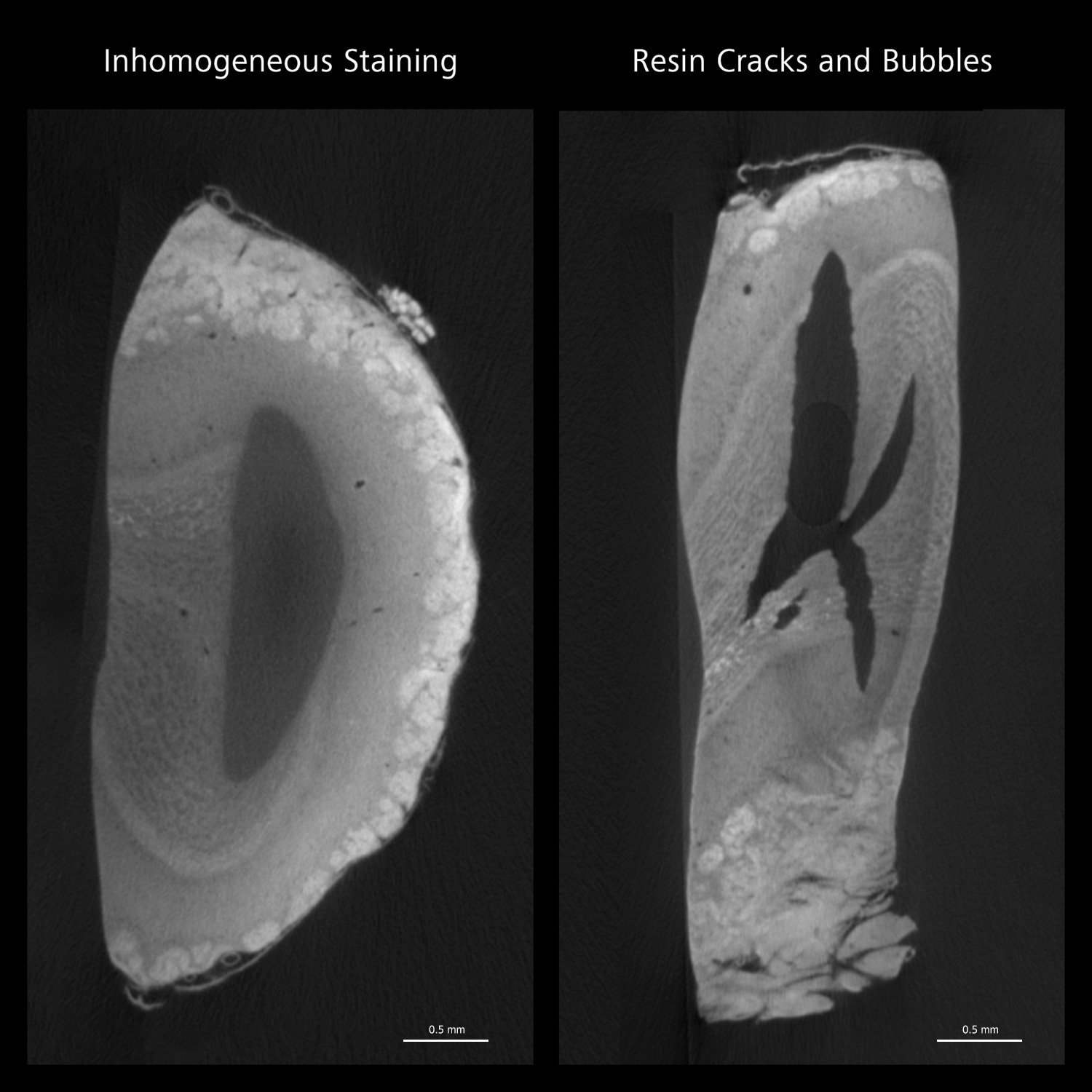 2D slices from 3D reconstructions of two mouse olfactory bulb slices prepared for volume EM and imaged with the Versa XRM