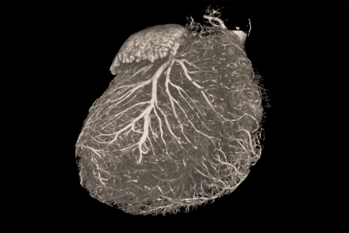Rat heart imaged using ZEISS Xradia Versa X-ray microscope. 