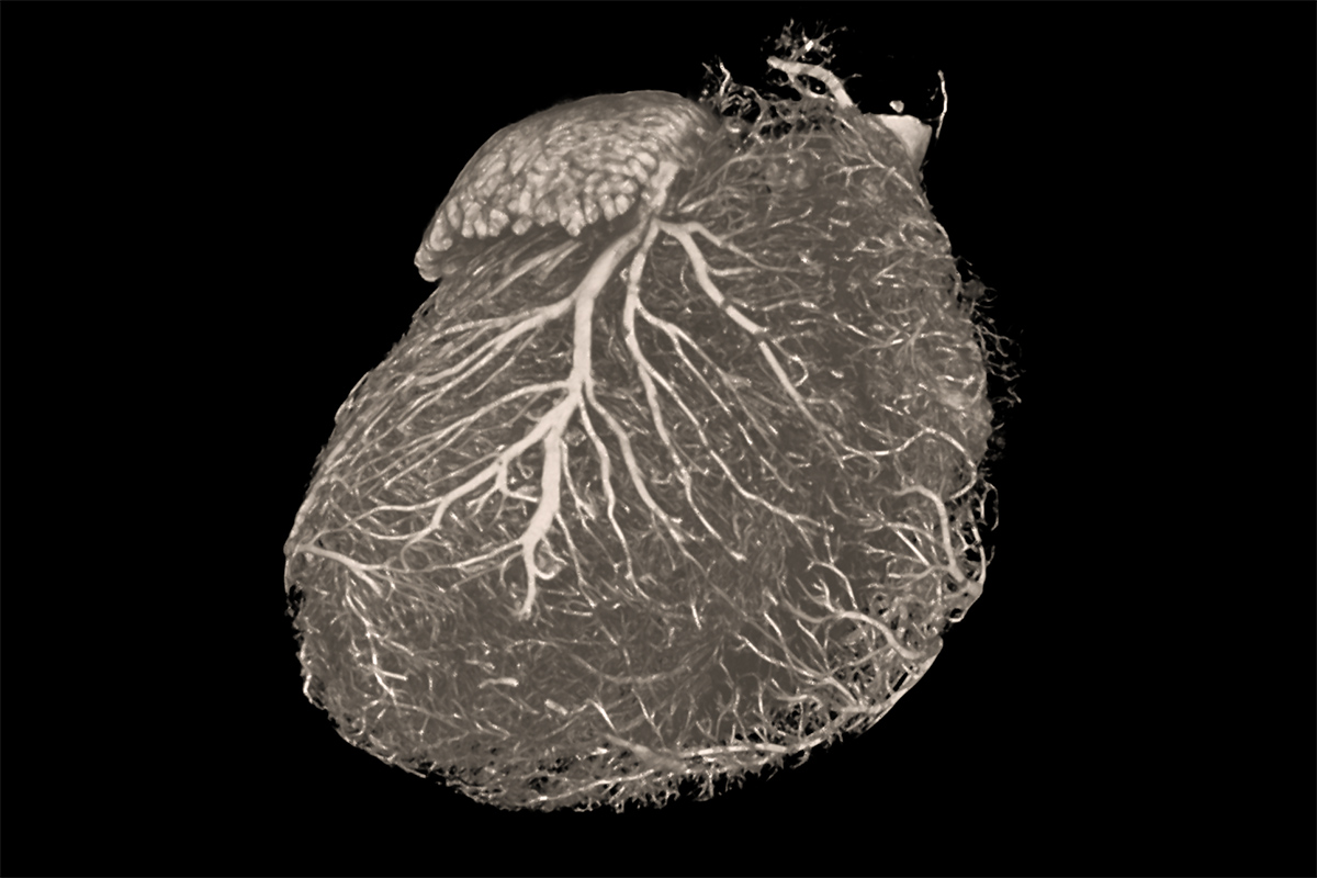Rat heart imaged using ZEISS Xradia Versa X-ray microscope. 