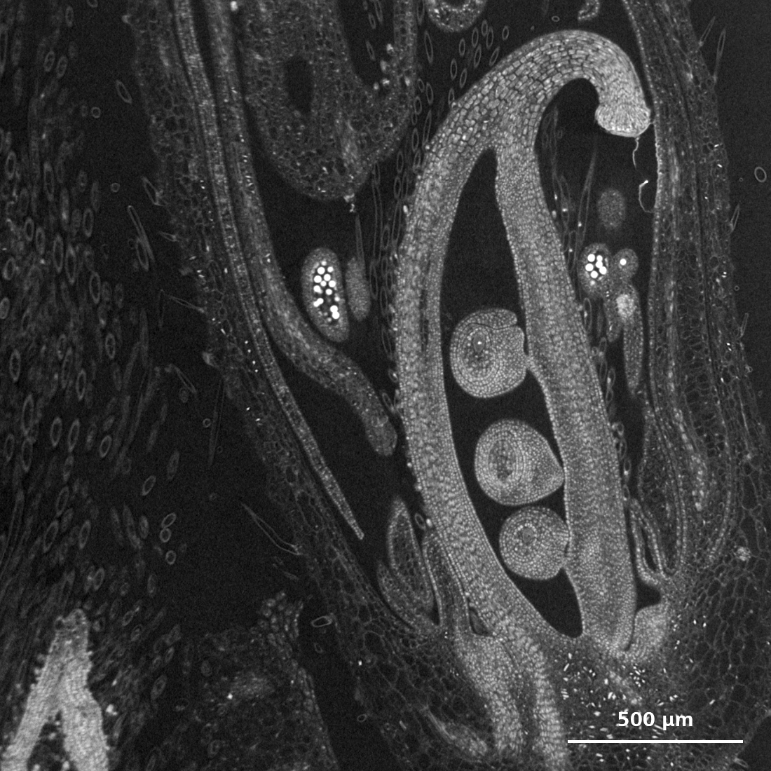 Soybean developing floral complex imaged with the ZEISS Xradia Versa X-ray microscope showing the ovary with developing ovules surrounded by the anthers containing bright pollen grains.