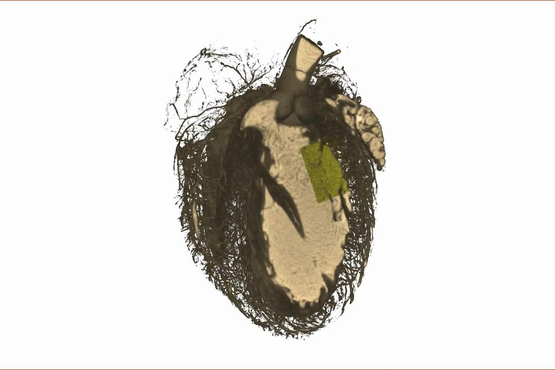 Rat Heart 3D dataset Versa XRM