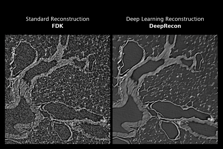 Mouse lung tissue. Equivalent single 2D sections through reconstructed datasets acquired with the same parameters (3001 projection images). Left: standard FDK reconstruction. Right: Deep learning reconstruction (DeepRecon).