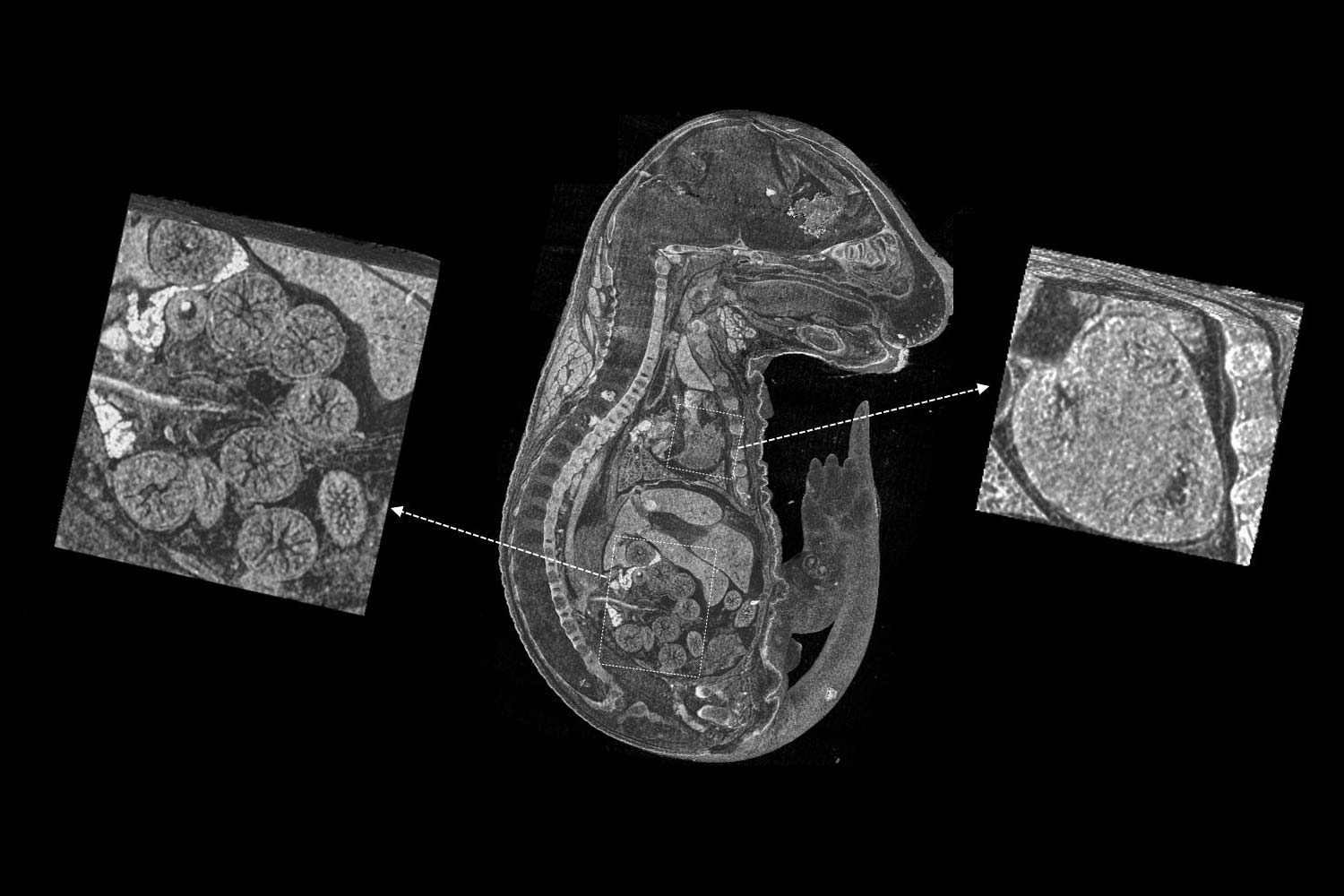 Unstained mouse embryo imaged with ZEISS Xradia Versa with high contrast capability Courtesy of Dr. Yukako Yagi, Massachusetts General Hospital, USA