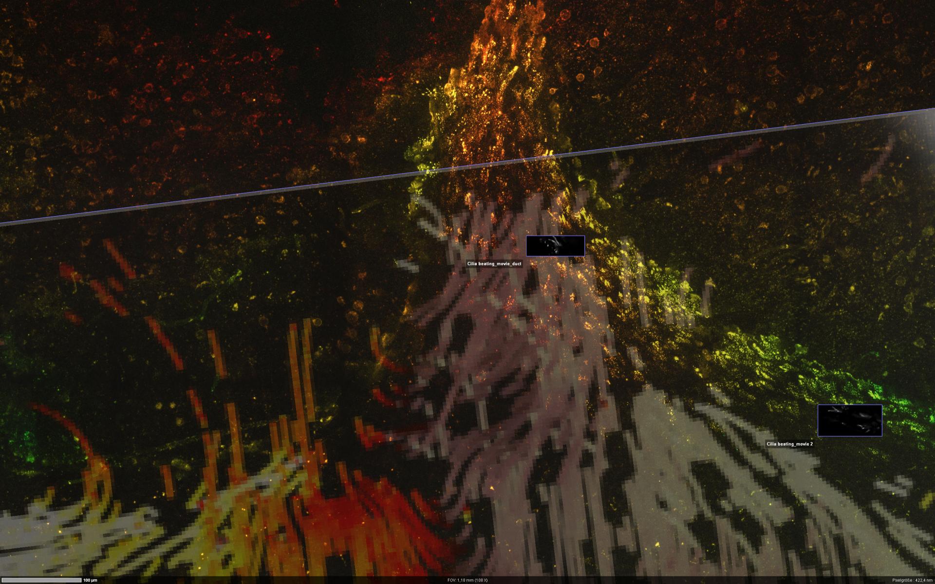 An overview of fluorescently labeled motile cilia on ependyma tissue explant from the mouse brain is quickly acquired by tiling with Airyscan 2 in Multiplex CO-8Y mode to find regions of interest.