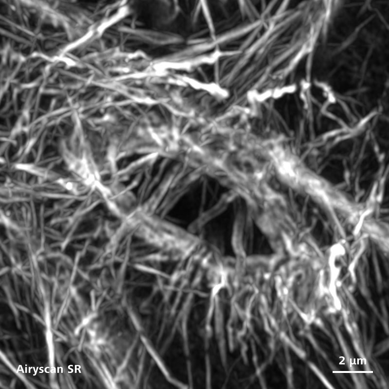 F-actin (Phalloidin) staining of a ring canal in the Drosophila egg chamber.