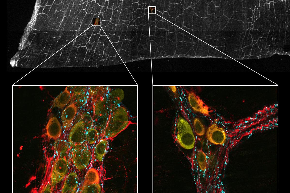 Mouse intestine tissue section stained for Substance P (cyan, Alexa 488) labeling the presynaptic contacts in the enteric nervous system, HuC/D (yellow, Alexa 568) labeling the enteric neurons, and neuronal Nitric Oxide Synthase (nNOS, red, Alexa 750) labeling a sub-population of enteric neurons. Sample Courtesy of Pieter Vanden Berghe, LENS & CIC, University of Leuven, Belgium.