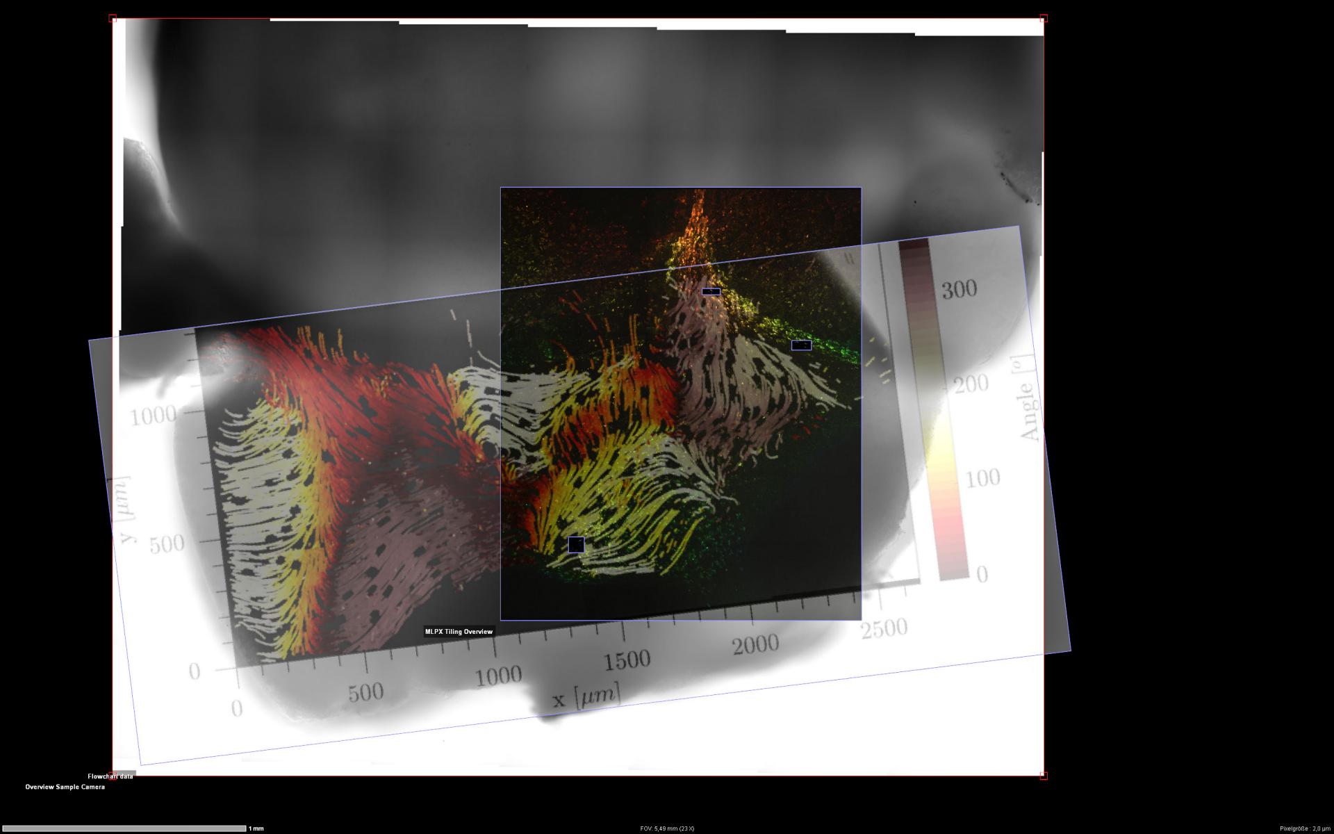 This ZEN Connect project documents the experiment performed with the tissue explant of ependyma from the ventricular system of a mouse brain. 