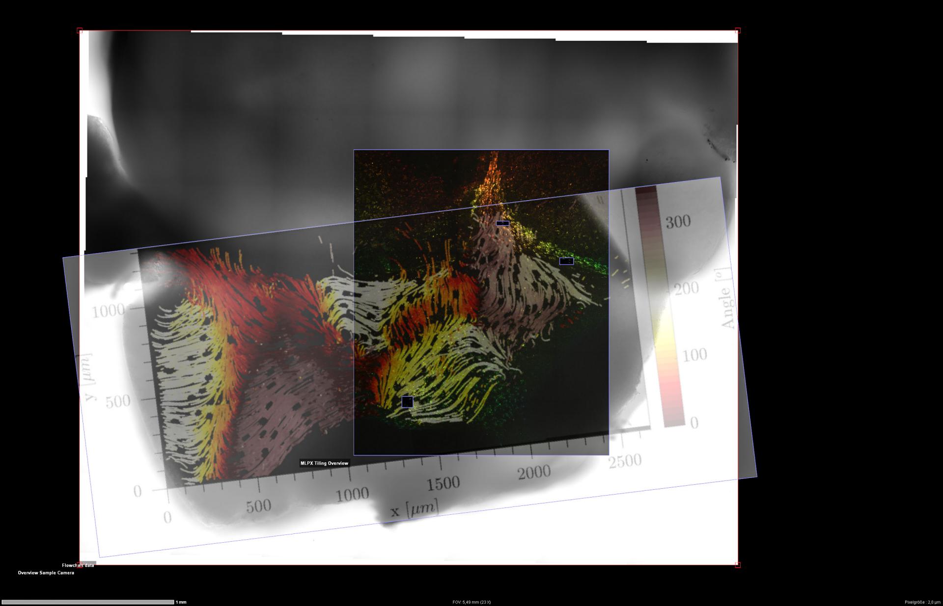 This ZEN Connect project documents the experiment performed with the tissue explant of ependyma from the ventricular system of a mouse brain.  