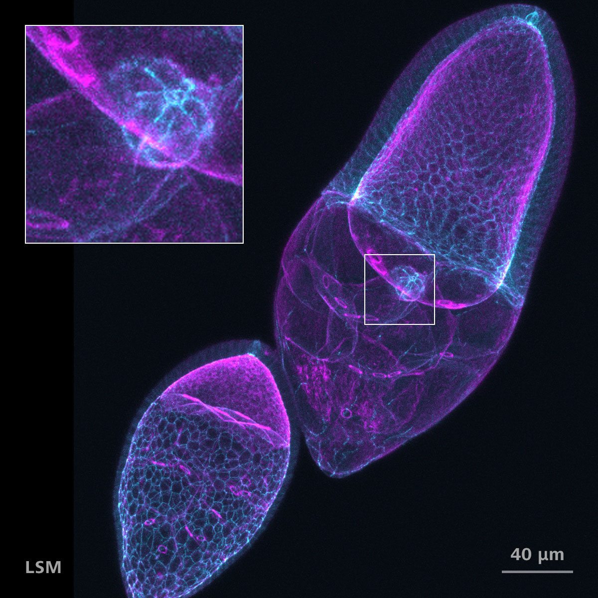 Drosophila egg chambers stained for F-actin (Phalloidin, magenta) and DE-Cadherin (cyan). Courtesy of T. Jacobs, AG Luschnig, WWU Münster; with T. Zobel, Münster Imaging Network, Germany
