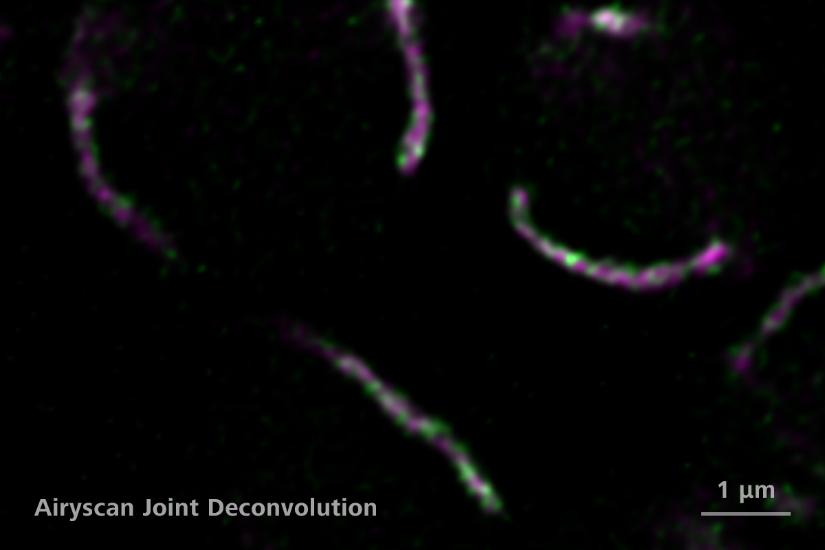 Budding yeast cells with protein localized to the mitochondrial inner membrane (green) and mitochondrial matrix (magenta). Courtesy of K. Subramanian / J. Nunnari, University of California, Davis, USA