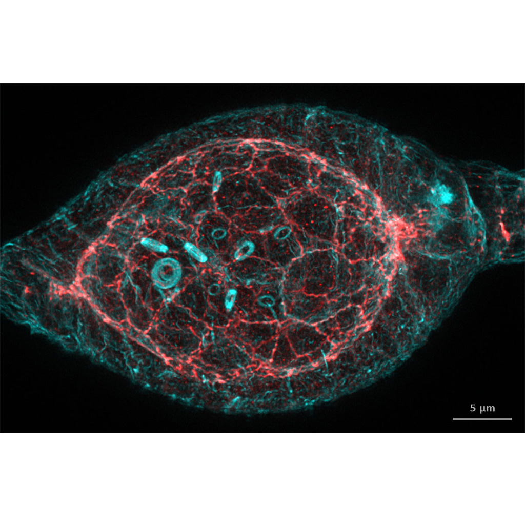 Drosophila germarium. Imaged with ZEISS Airyscan 2 followed by Joint Deconvolution. Courtesy of T. Jacobs, AG Luschnig, WWU Münster; with T. Zobel, Münster Imaging Network, Germany 