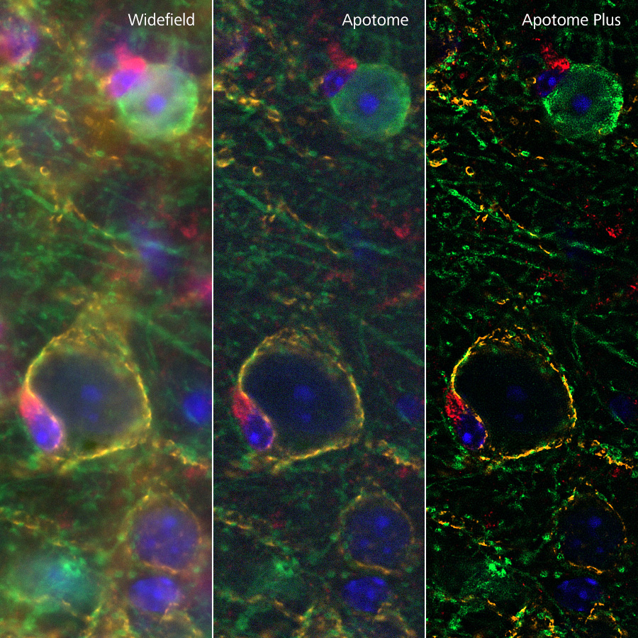 35 μm sagittal section of adult mouse brain, imaged with ZEISS Axio Observer and ZEISS Apotome, processed with Apotome Plus. Sample courtesy of University of California, Davis / NIH NeuroMab Facility.