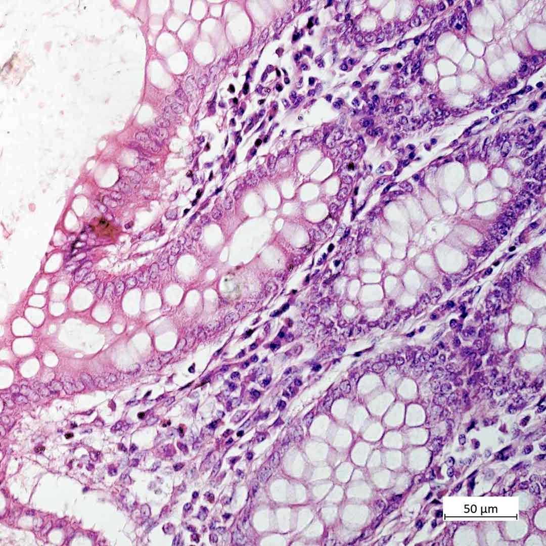 Intestine, HE staining, brightfield contrast