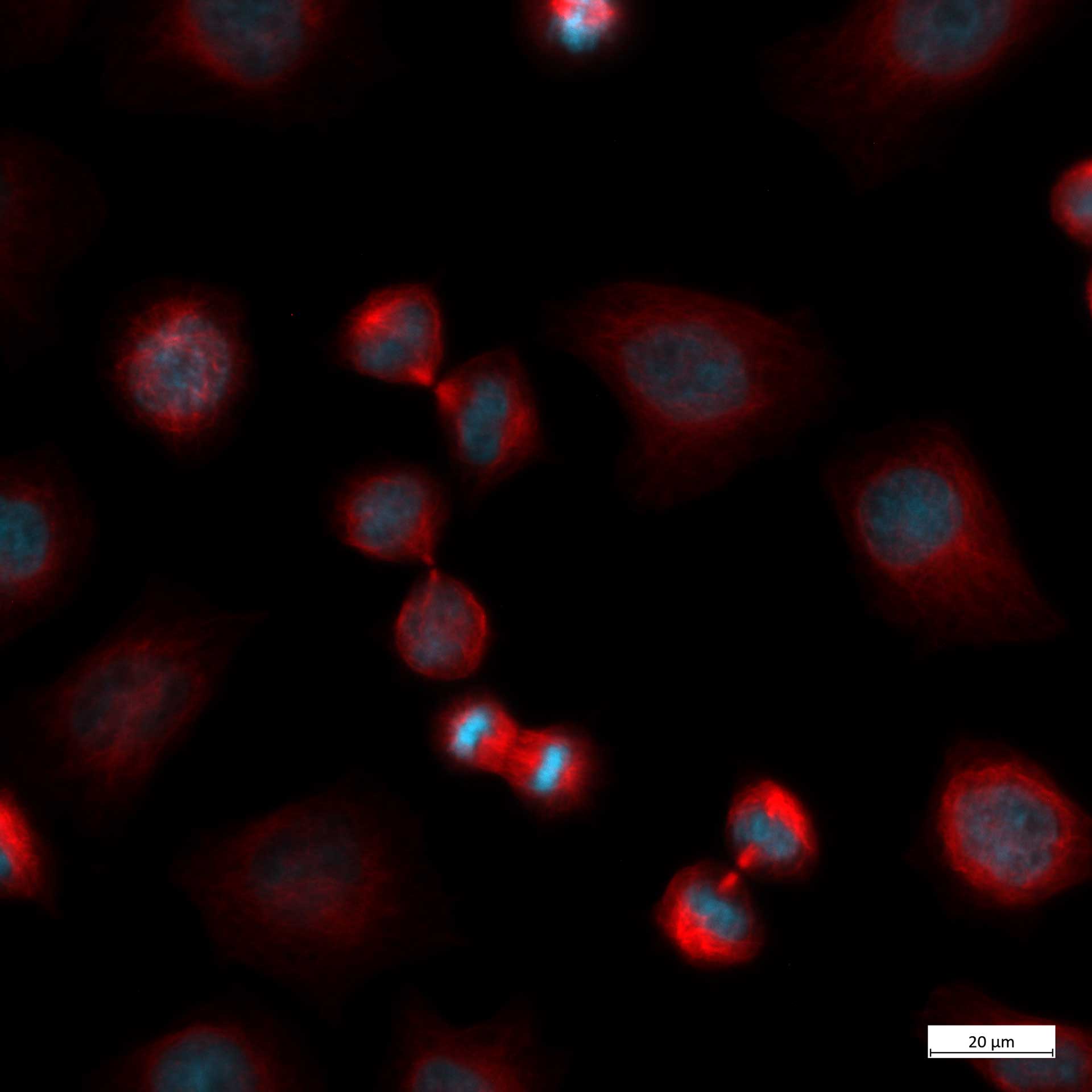HeLa Kyoto cell line, acquired with Axiovert 5 in fluorescence contrast