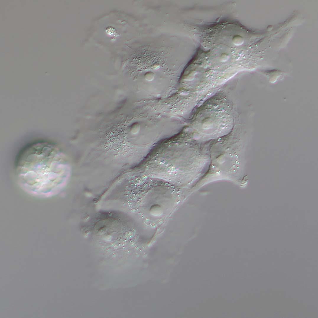 Cells in transmitted light PlasDIC