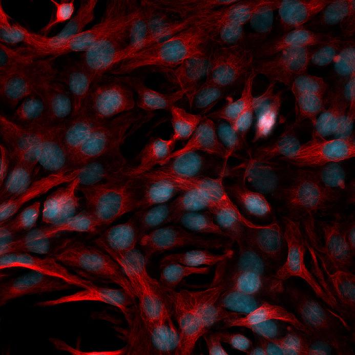 HeLa Kyoto cells, multichannel fluorescence image